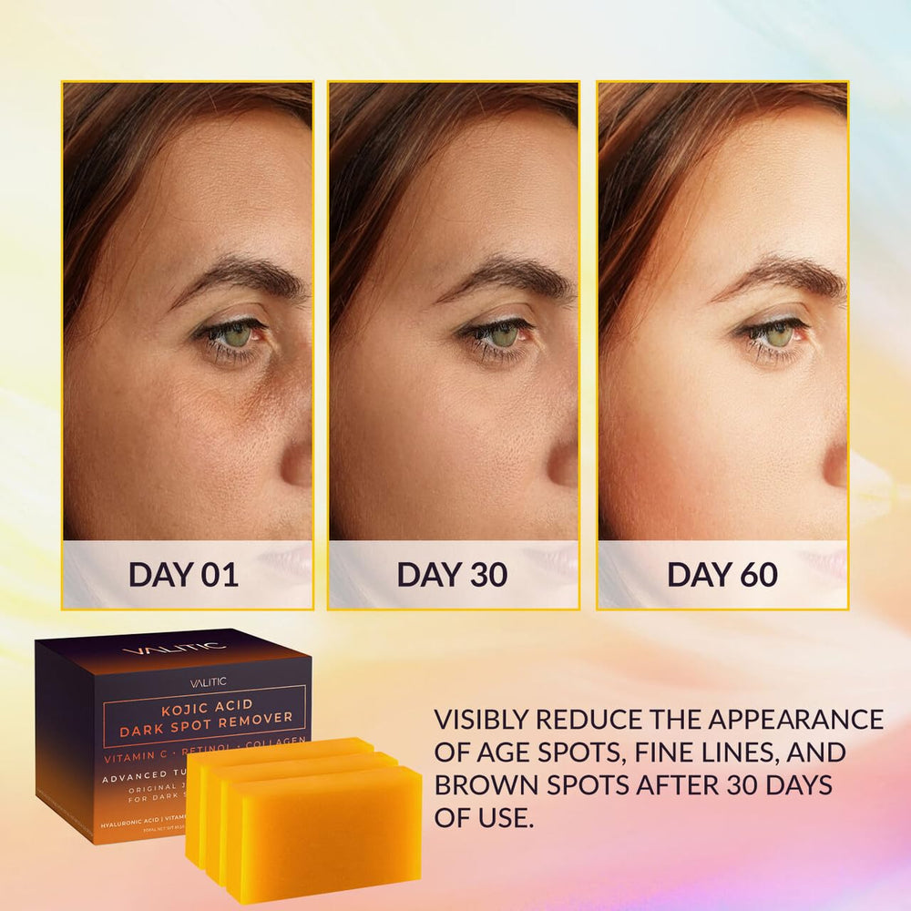 VALITIC Savon Kojic Acid – barre, offre hydratation et douceur à la peau.