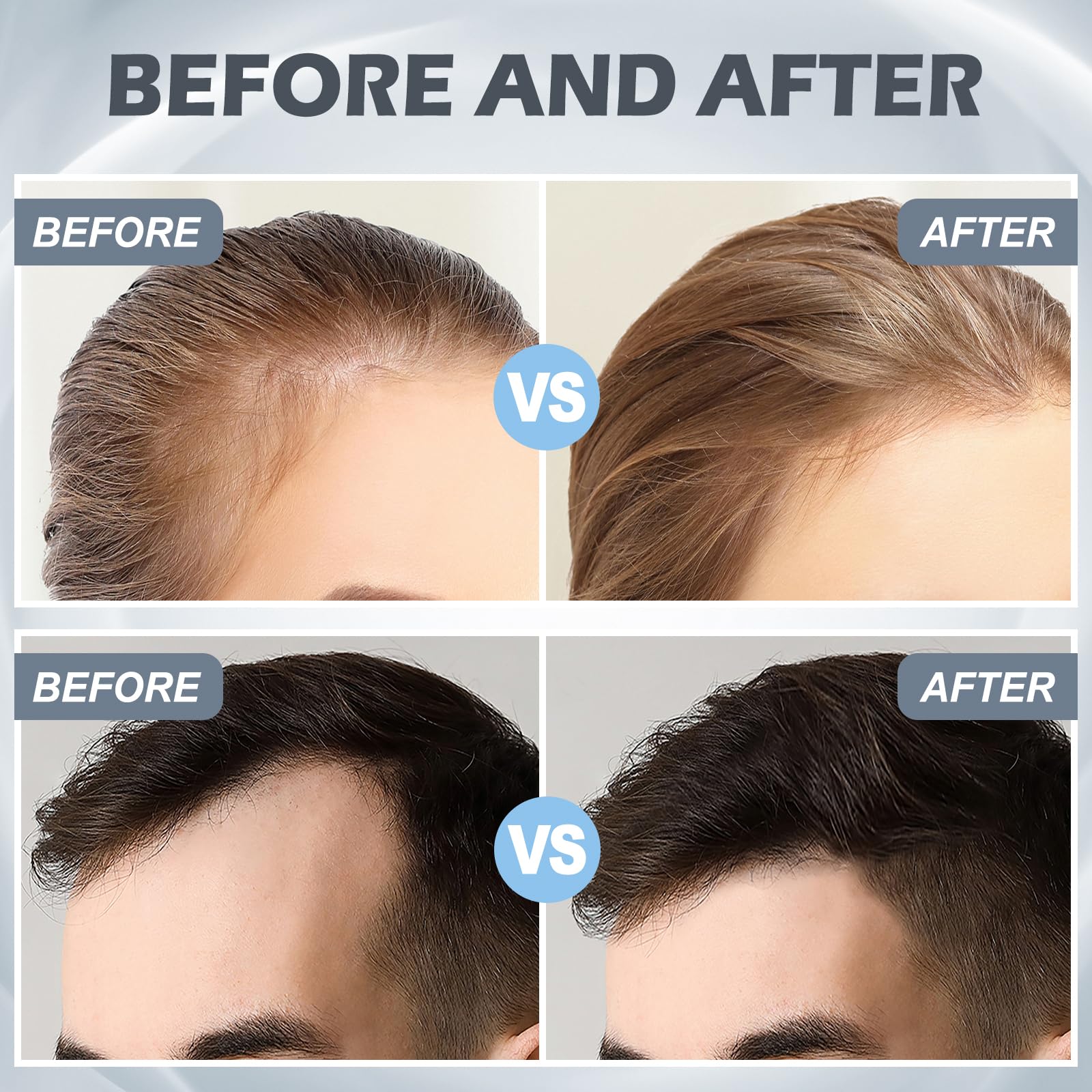 VANKEPYO Derma Roller barbe: entretien pratique à domicile.