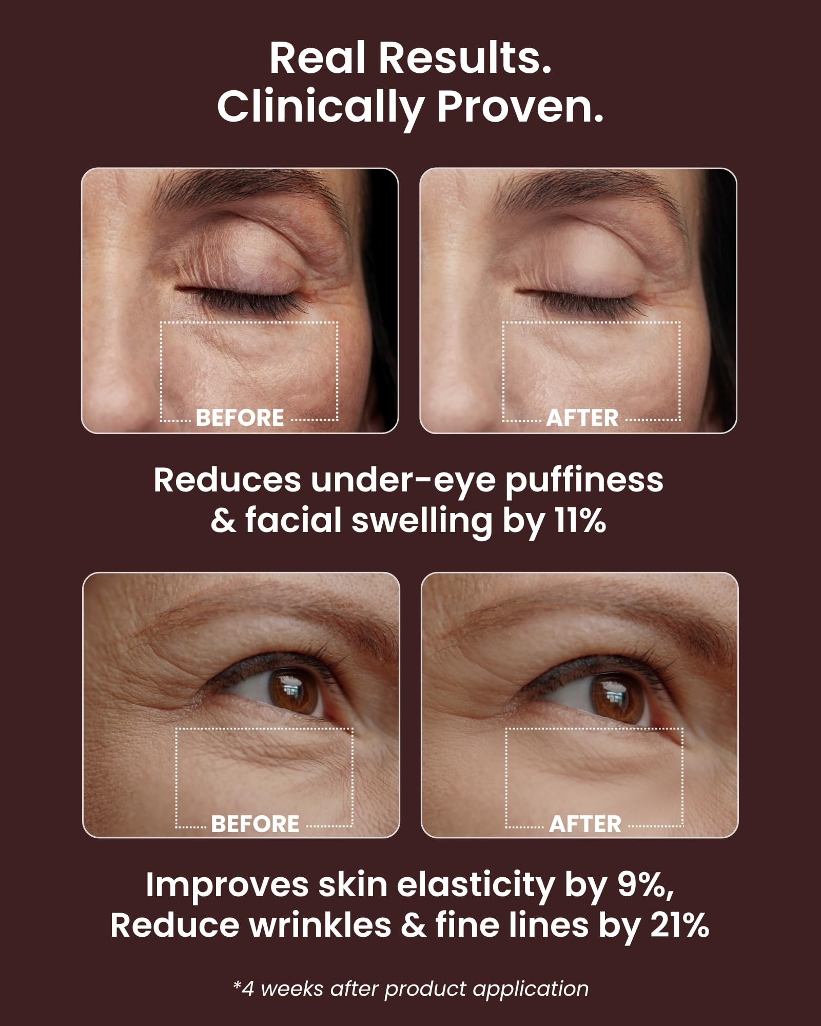 VAROL Ice Roll Serum collagène poisson — favorise l élasticité et l hydratation.