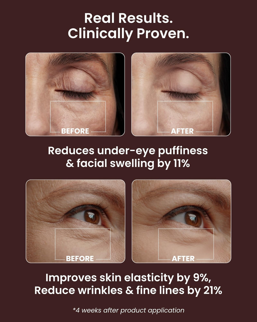 VAROL Ice Roll Serum collagène poisson — favorise l élasticité et l hydratation.
