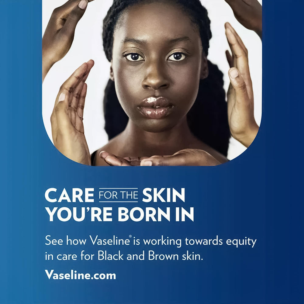 Kit voyage Vaseline Lip Therapy pour soin des lèvres.