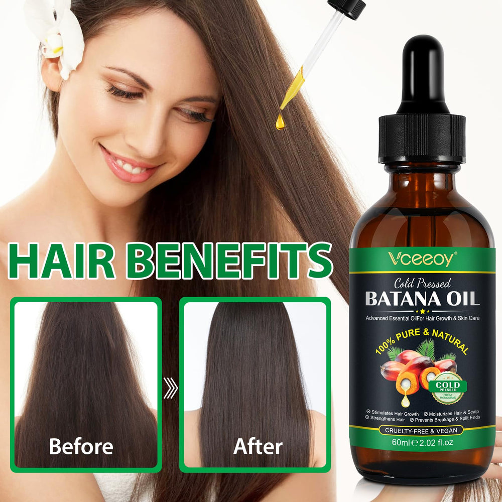 Vceeoy Batana Oil, massage cuir chevelu pour nourrir les racines