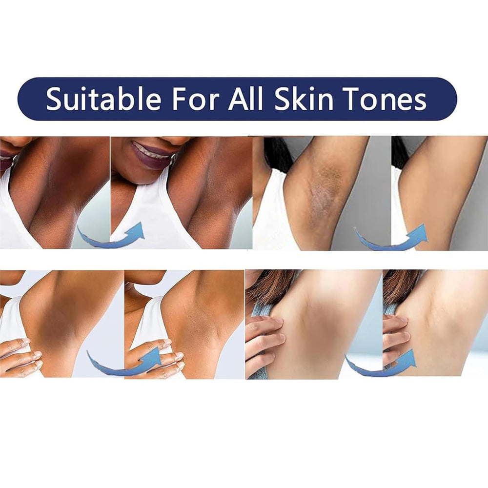 Vcetree elbows care for smoother, radiant skin
