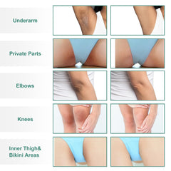 Applied VCETree cream on intimate areas for even tone