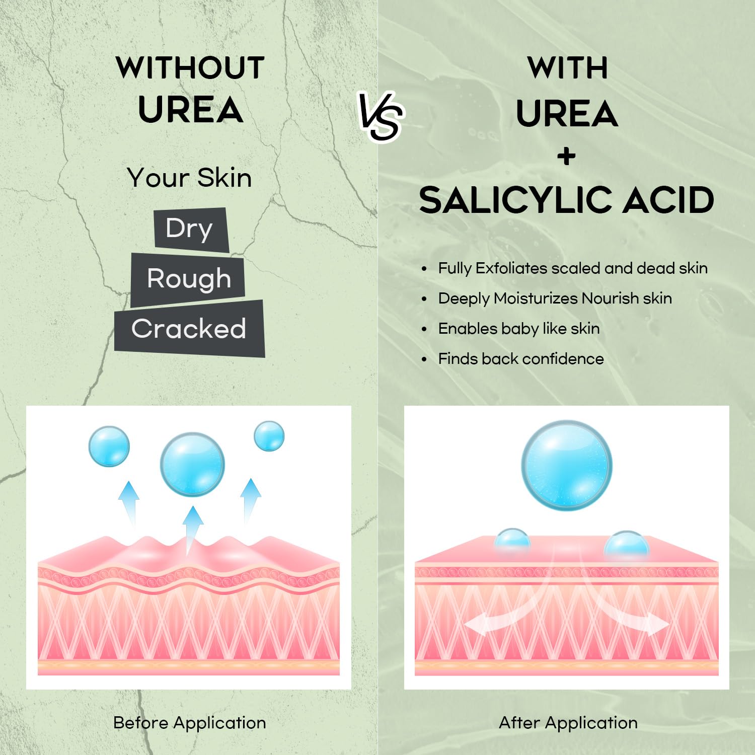 Vebuni Crème Urée 42% texture riche qui absorbe rapidement.