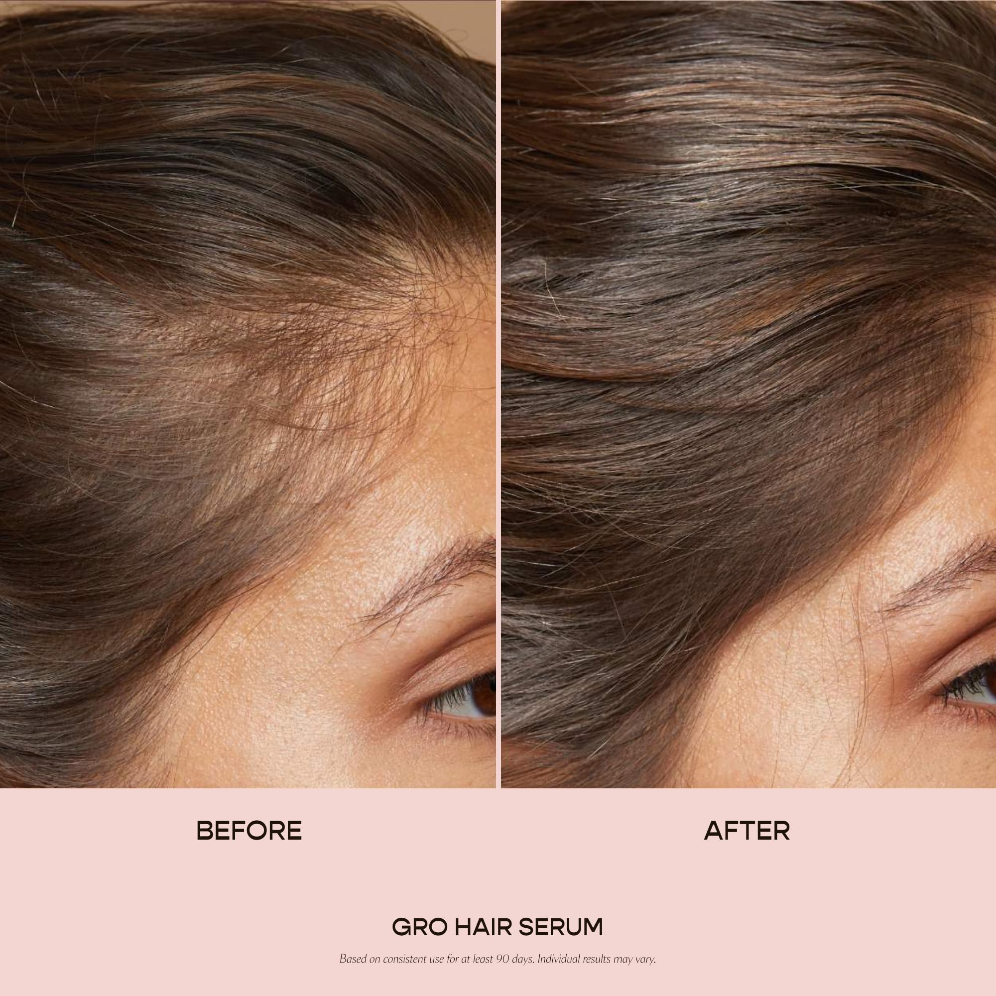 Sérum GRO appliqué sur le cuir chevelu, revitalise les cheveux et favorise le soin.