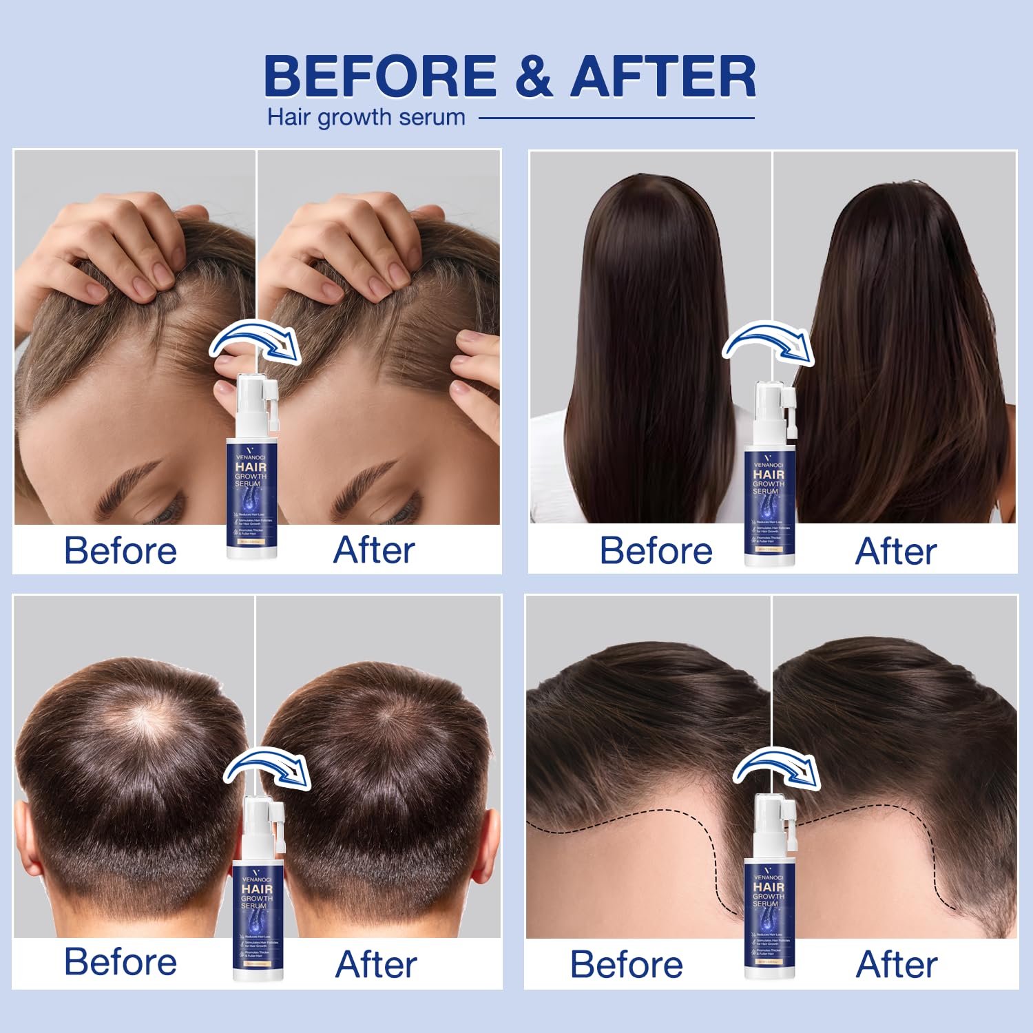 Venanoci Biotine, soin nourrissant pour cheveux plus forts.