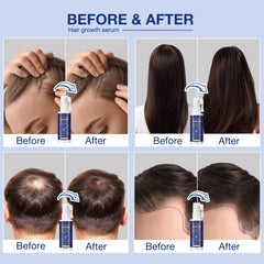 Venanoci Biotine, soin nourrissant pour cheveux plus forts.