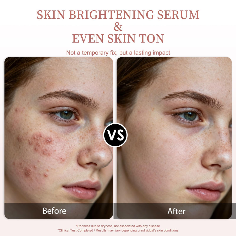 Sérum Veyoraus vitamine C – uniformité du teint et réduction des zones foncées.