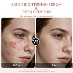 Sérum Veyoraus vitamine C – uniformité du teint et réduction des zones foncées.