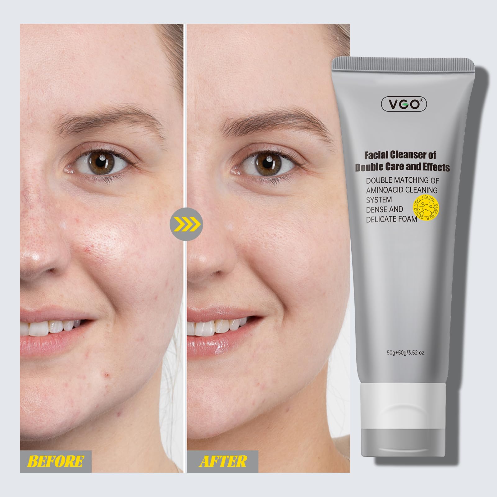 VGO formula is mineral oil free for all skin types.