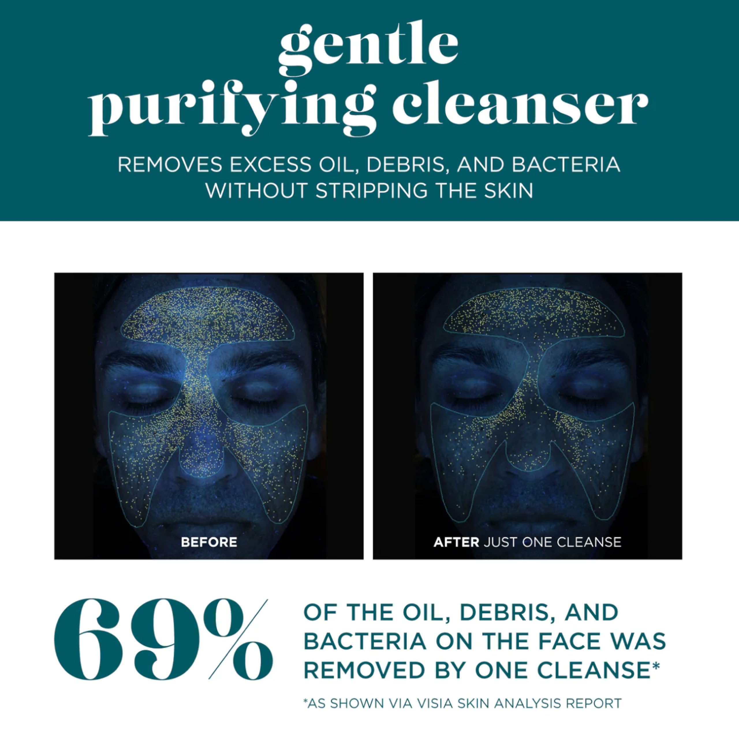 VI DERM Gentle Purifying Cleanser utilisation quotidienne — peau propre et confortable.