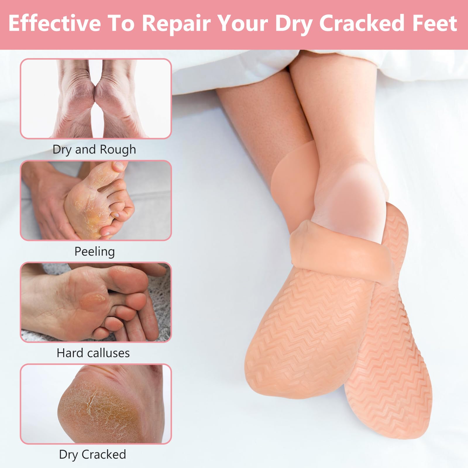 Chaussettes Vigdit XL en silicone longues pour pieds plus larges.