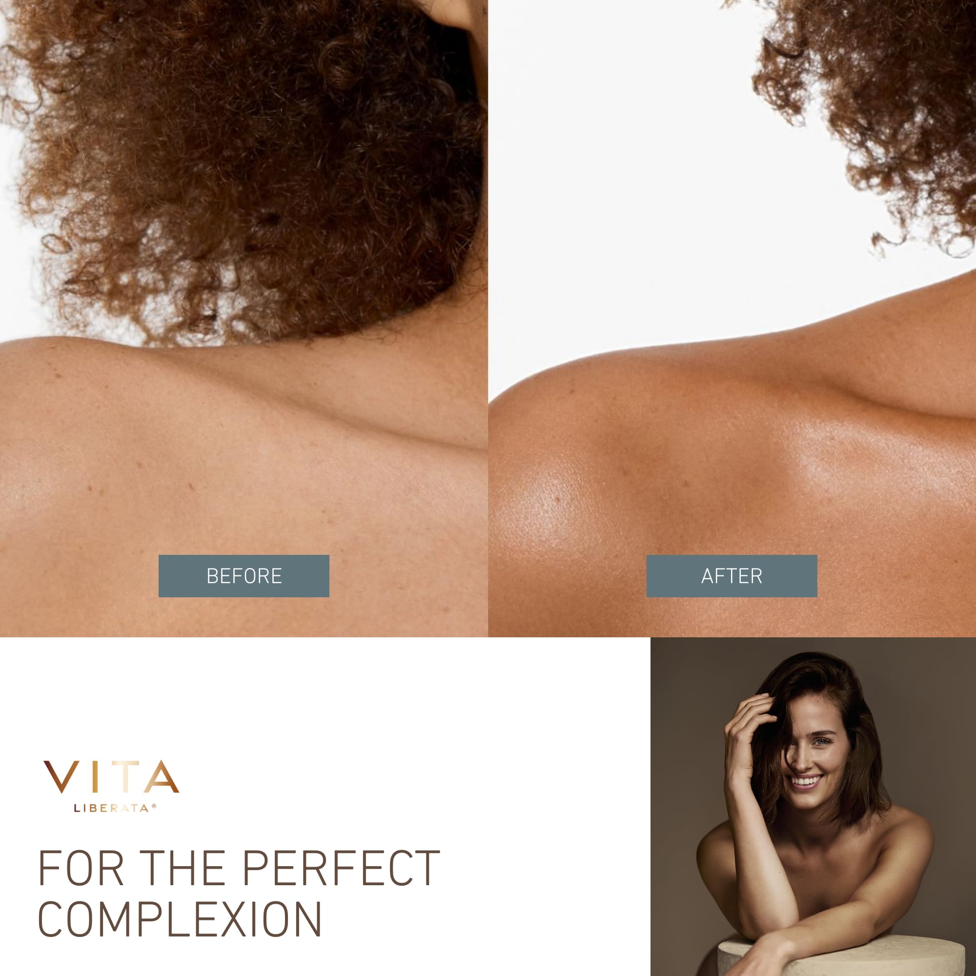 Avant/après avec Vita Liberata Body Blur pour teint uniforme et temporaire.