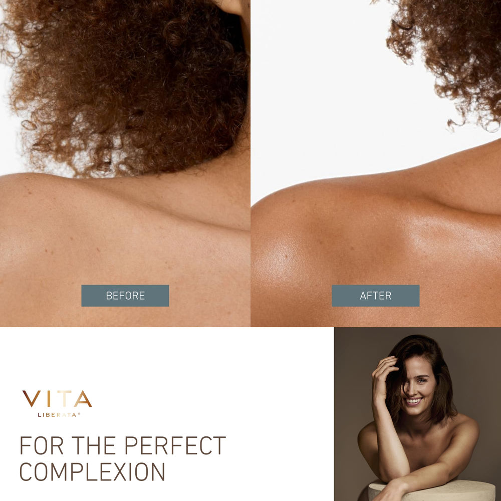 Avant/après avec Vita Liberata Body Blur pour teint uniforme et temporaire.