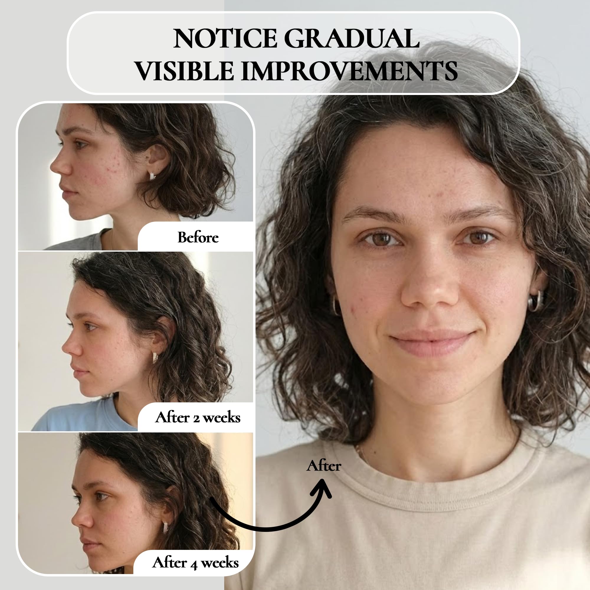 Vivo Per Lei – agit sur pores et points noirs pour une apparence plus nette.