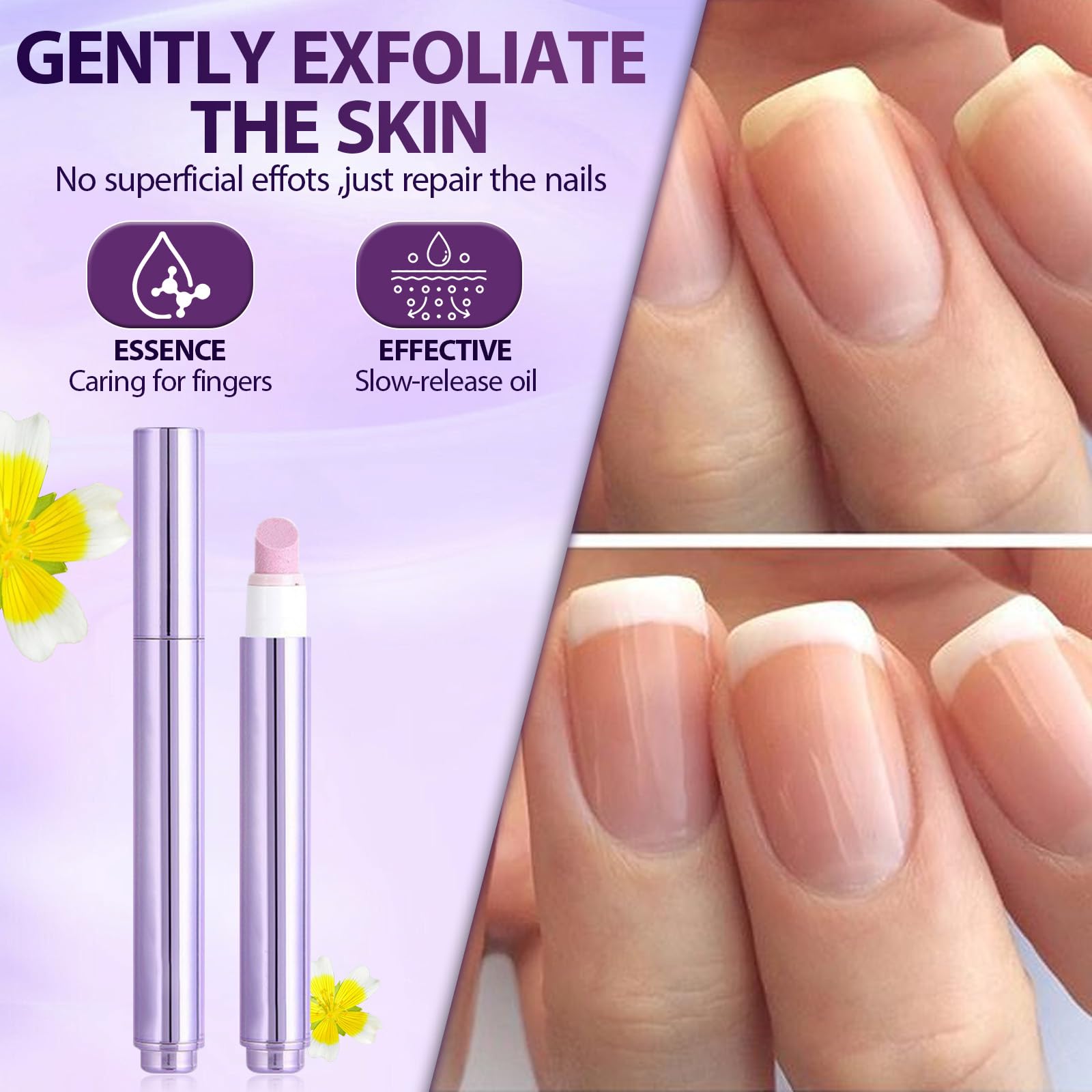 VocdFing ongles abîmés hydratés et renforcés