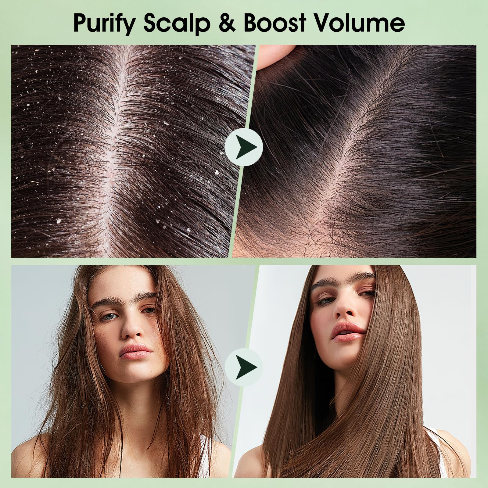 VOERUY Masseur capillaire en silicone: massage efficace du cuir chevelu.