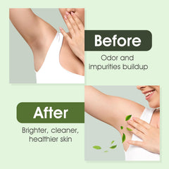VOERUY Savon Detox, exfoliation douce au charbon.