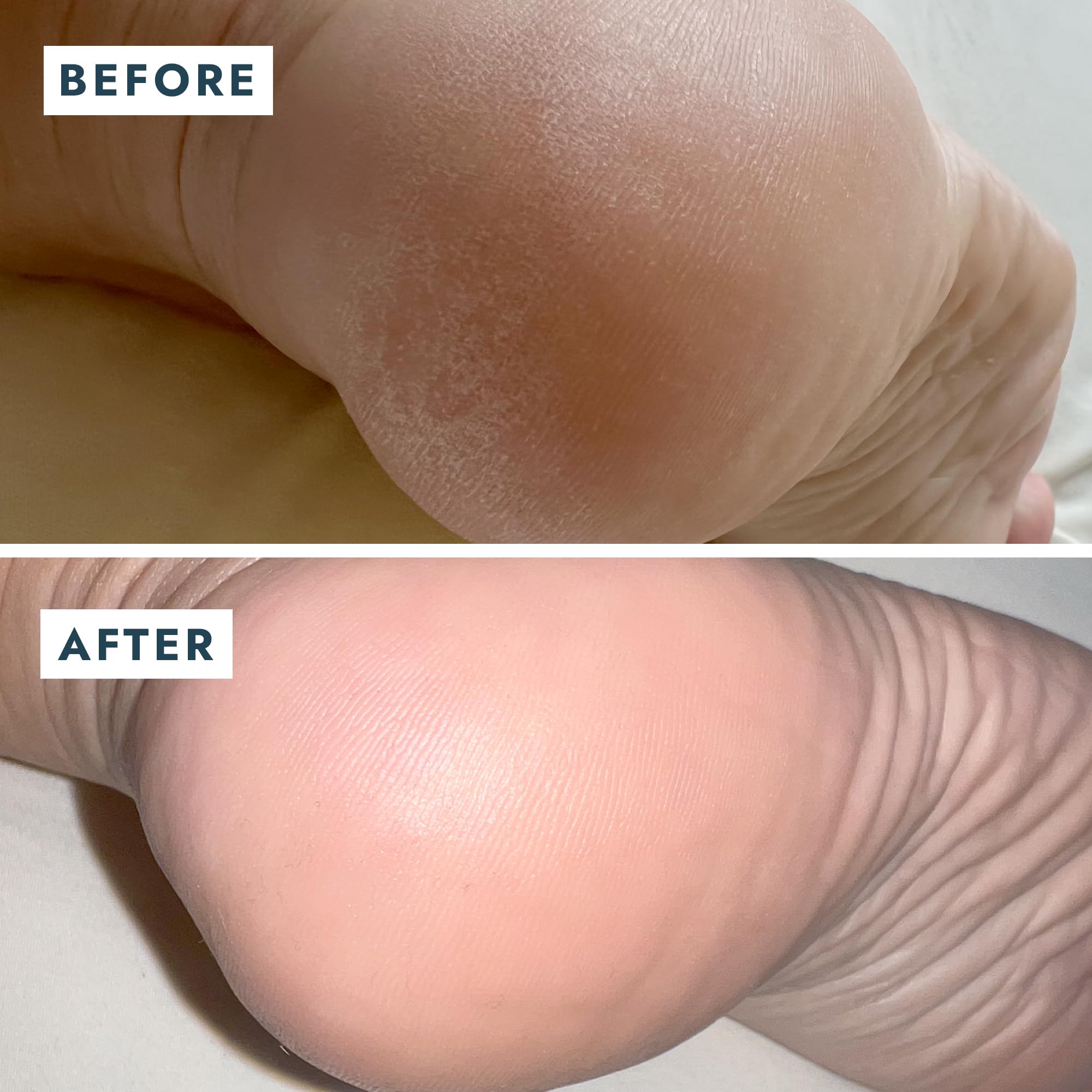 VOESH Solemate douceur pieds après application, sensation agréable et nourrissante.
