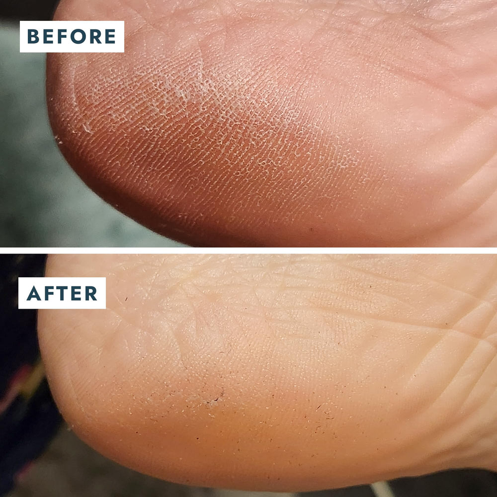 VOESH Solemate huile macadamia et jojoba pour pieds confortables.