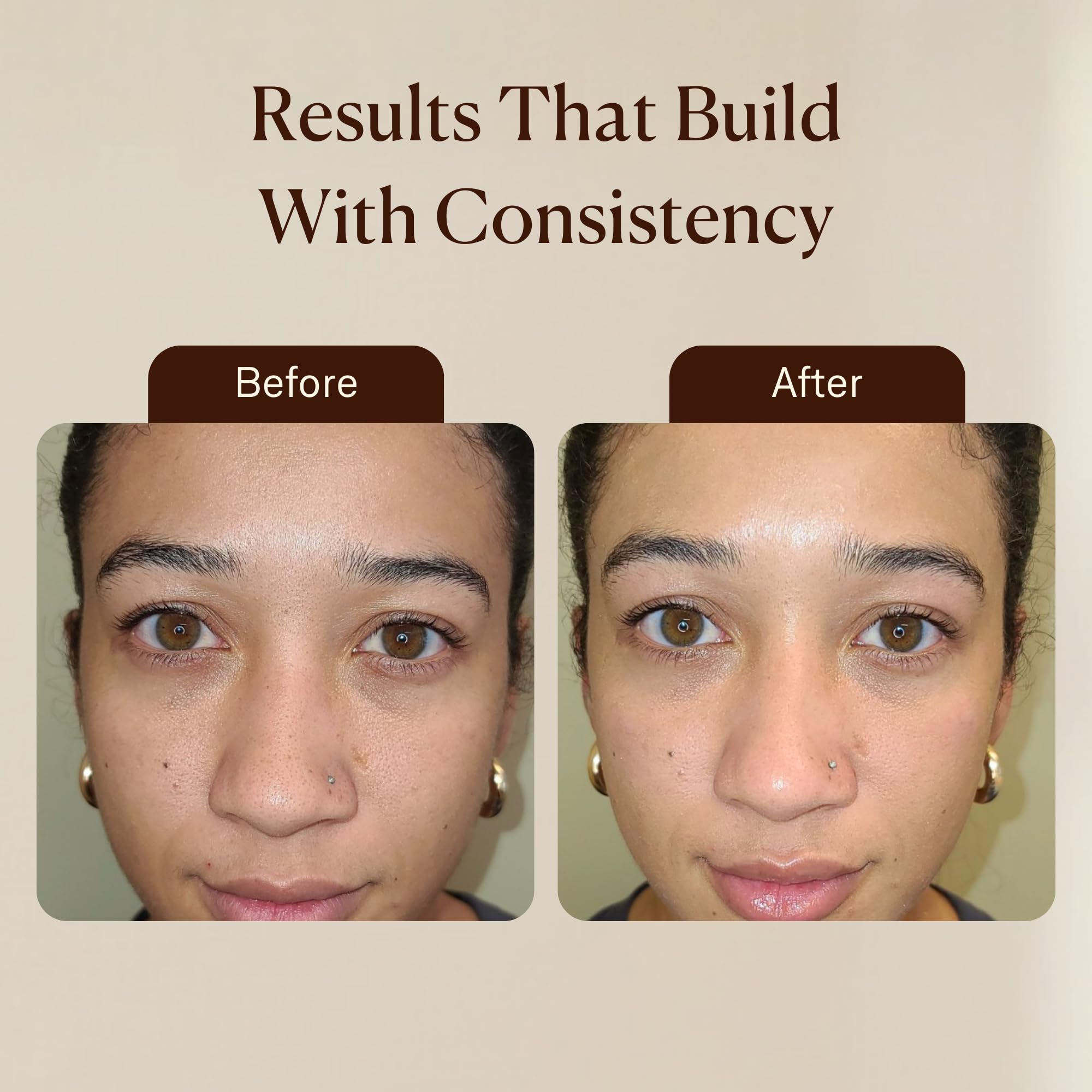 VogueNow rasoir-dermaplanage facilite une exfoliation légère et efficace.