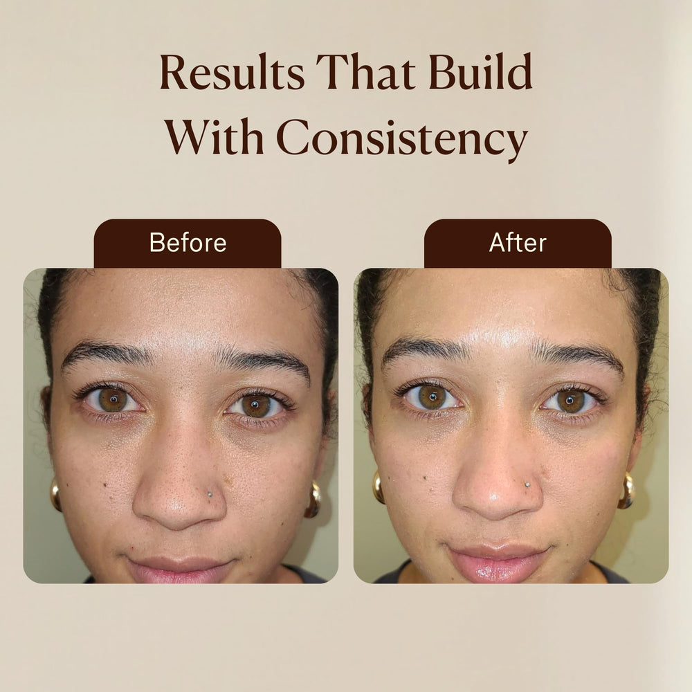 VogueNow rasoir-dermaplanage facilite une exfoliation légère et efficace.