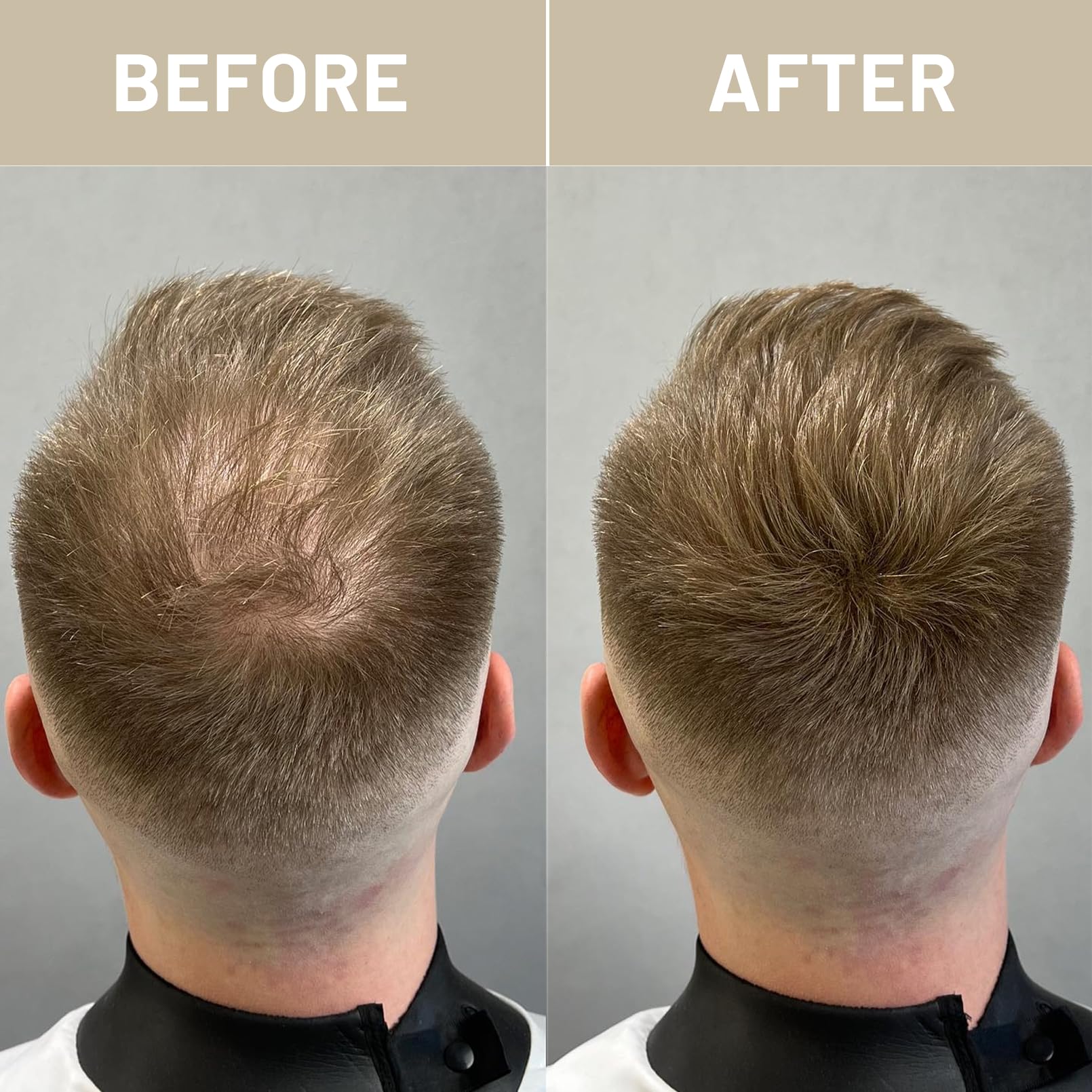 VOLLUCK fibres application rapide pour démarrage facile sur tous les cheveux.