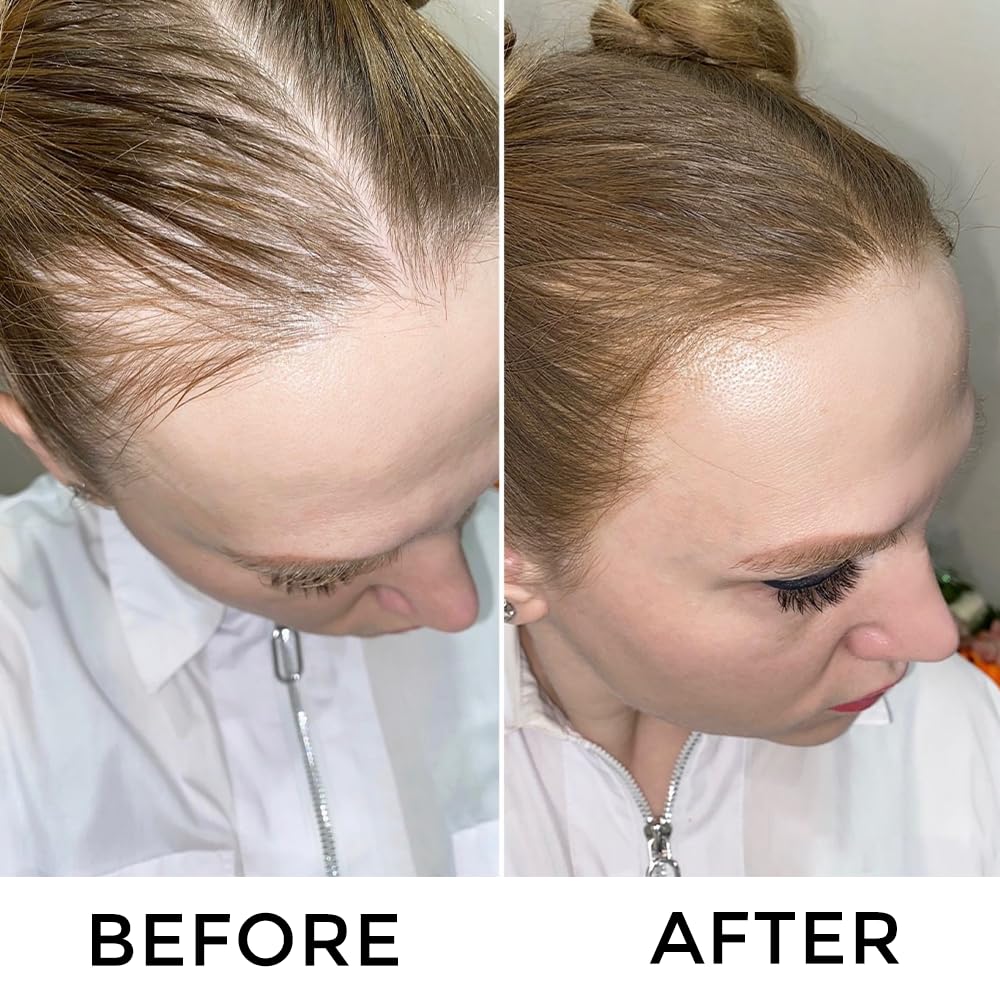 VOLLUCK utilisation facile à domicile ou en voyage sans pro.