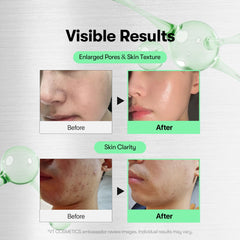 VT COSMETICS CICA Reedle Shot 700 — Texture fluide et absorption rapide.