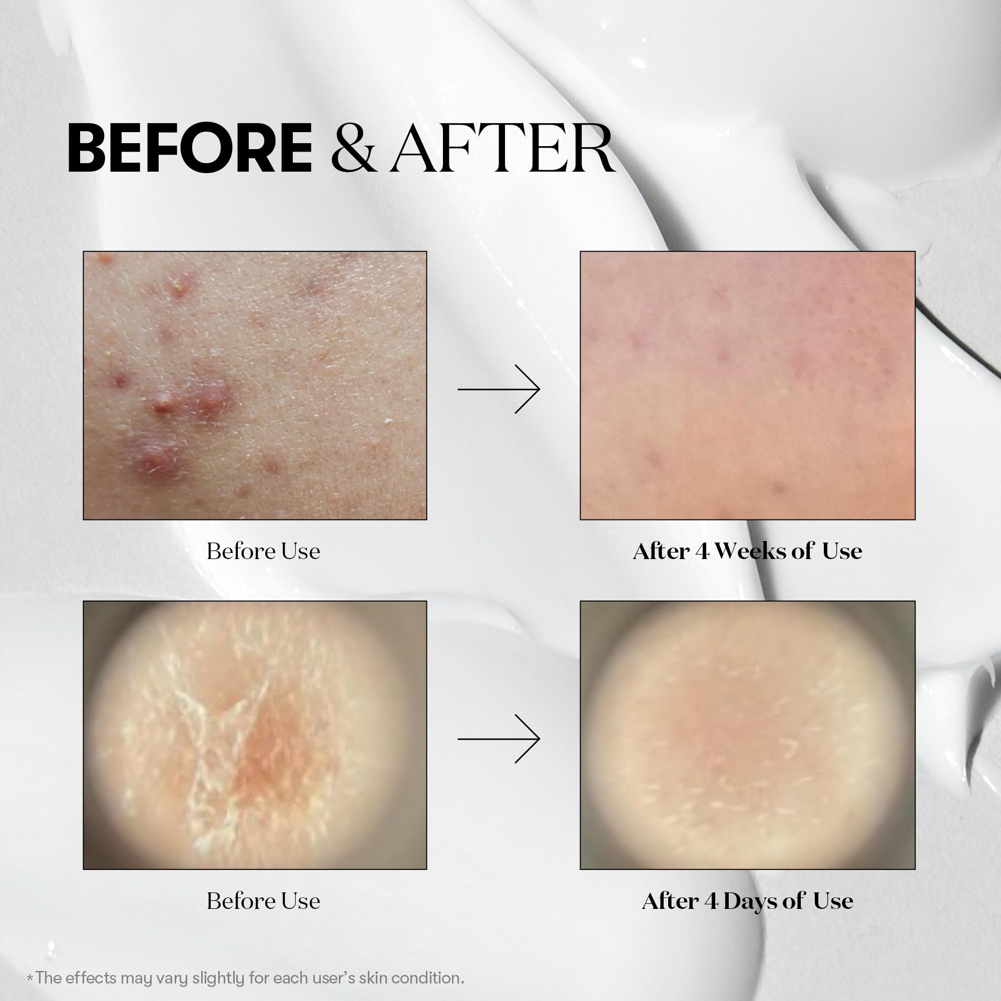 VT COSMETICS Reedle Shot 300 en flacon, absorption en profondeur.