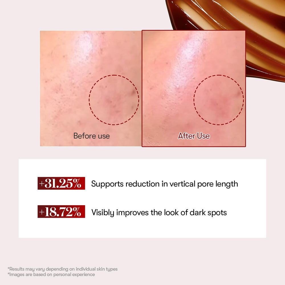 VT COSMETICS Reedle Shot formule-exosome-microneedling: formule innovante pour réveiller l’éclat cutané.