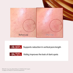 VT COSMETICS Reedle Shot formule-exosome-microneedling: formule innovante pour réveiller l’éclat cutané.