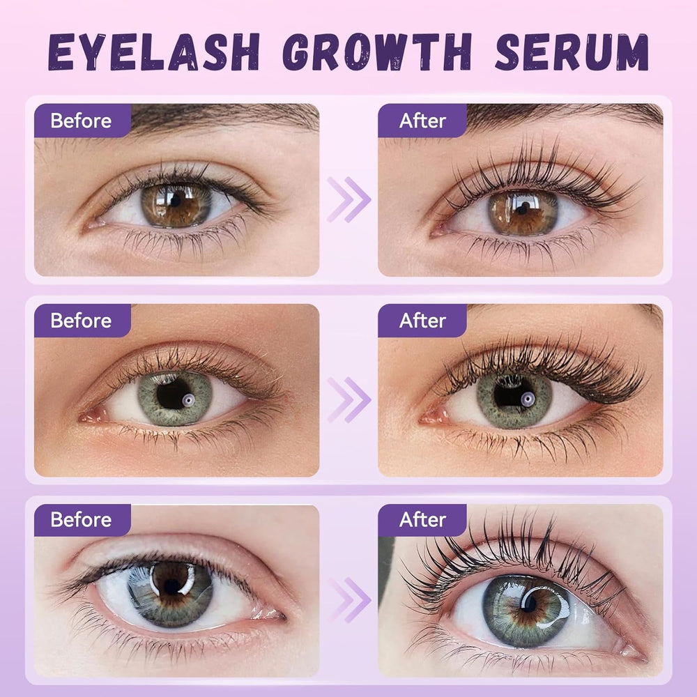 Zoom sur cils naturels bénéficiant du soin Vxzit.