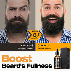 Vitamine E dans l'huile Waking Forest pour renforcer et protéger la barbe