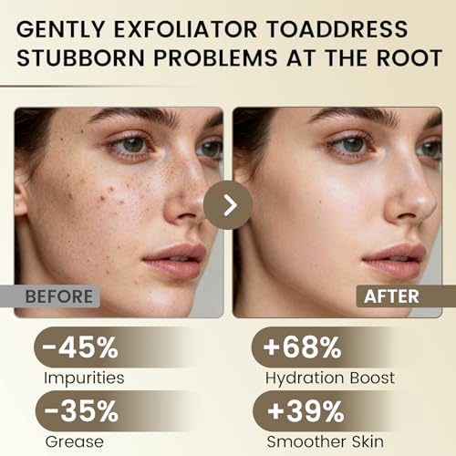 Wanerbsr Peel Shot Exfoliant extraits-riz-noir: actifs revitalisants pour la peau.