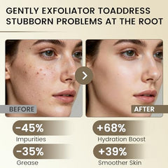 Wanerbsr Peel Shot Exfoliant extraits-riz-noir: actifs revitalisants pour la peau.