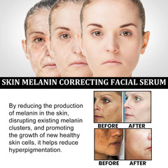 Peau hydratée et repulpée après l’application du WeslaPlus Serum.