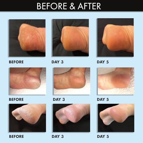 Whish masque-pieds exfoliation nocturne application facile