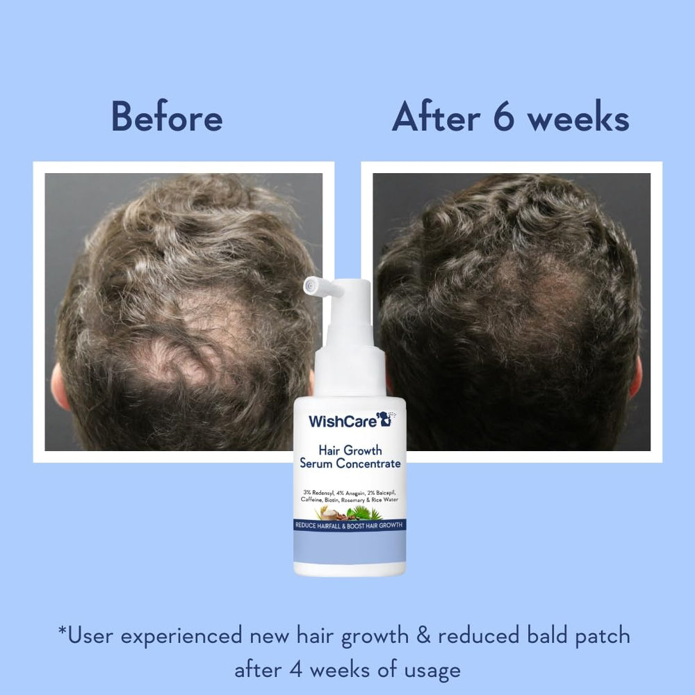 WishCare sérum croissance cheveux – actif Anagain: cycle capillaire équilibré.