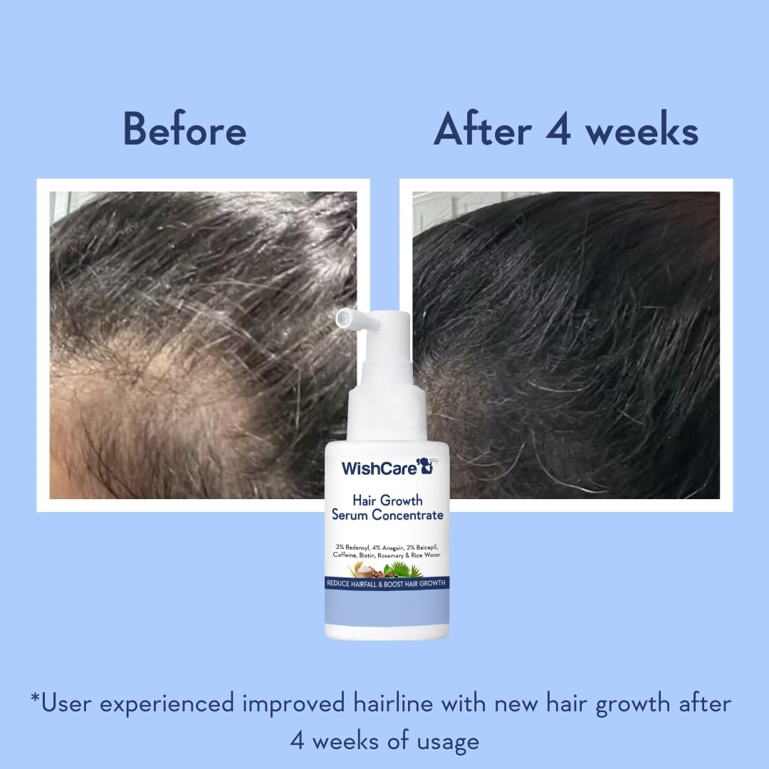 WishCare sérum croissance cheveux – actifs Redensyl: densité visuelle potentielle.