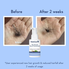WishCare sérum croissance cheveux – texture légère: impression sans résidu gras.