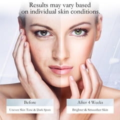 WMK Dark Spot Remover — texture légère qui pénètre facilement sur les peaux sensibles