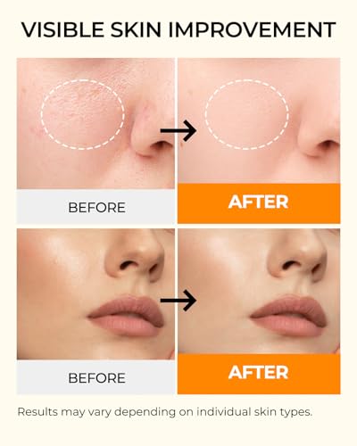 Actifs curcuma et kojic signant l’éclat naturel du soin Wokatta.