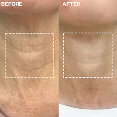 Patch réutilisable Wrinkles Schminkles en silicone, soin durable du cou au quotidien.