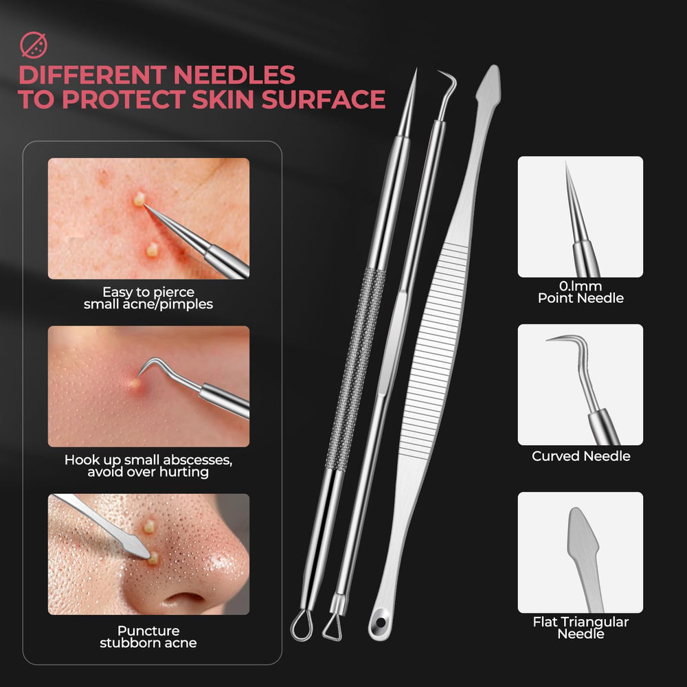 WSYUB outils extraction comédons, kit pro et sûr pour le visage