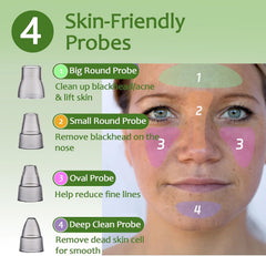 Xamoca aspirateur-pores: niveau 3 pour une peau plus nette après une routine ciblée.