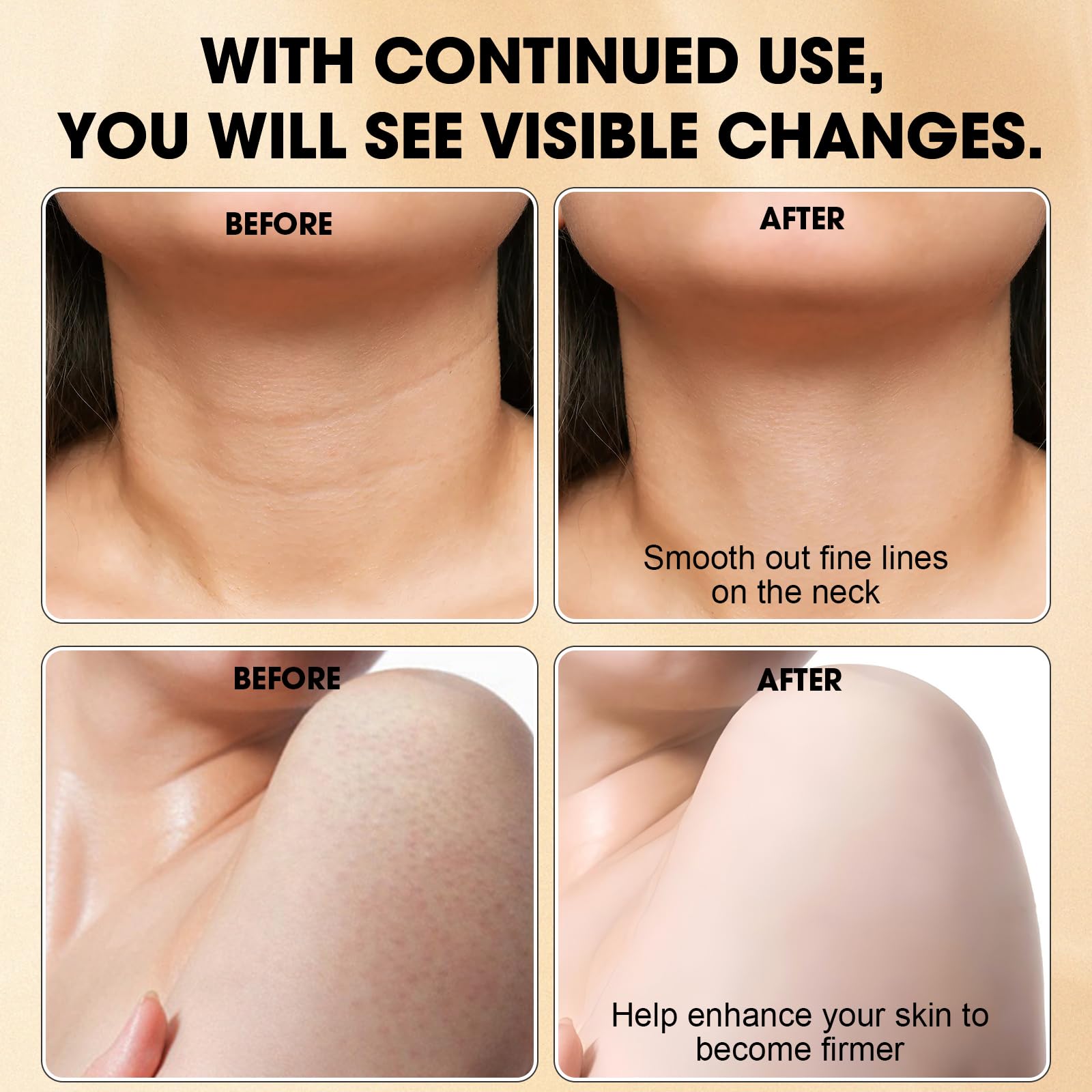 Xaninp Champagne Crème Corps – extraits botaniques stimulants, microcirculation améliorée et éclat.