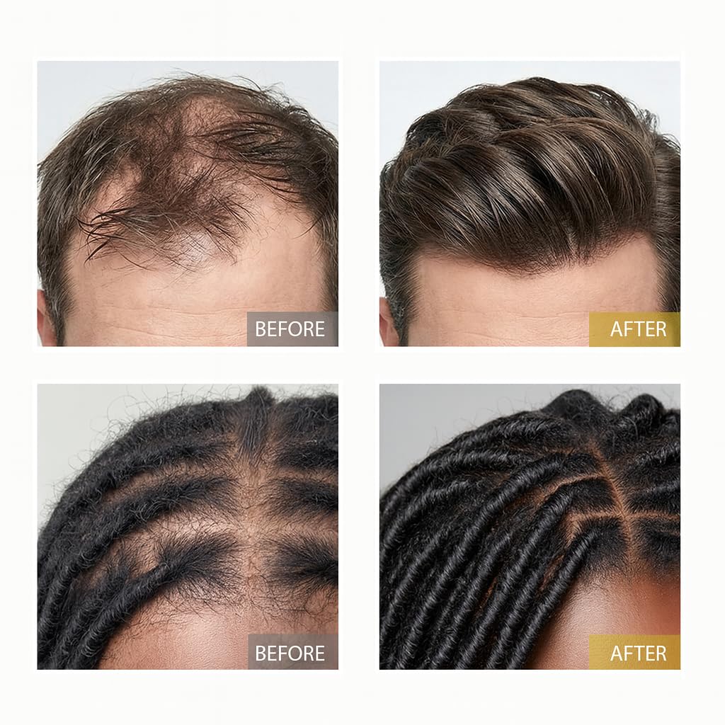 XILRVON oil being applied to scalp for massage demonstration.