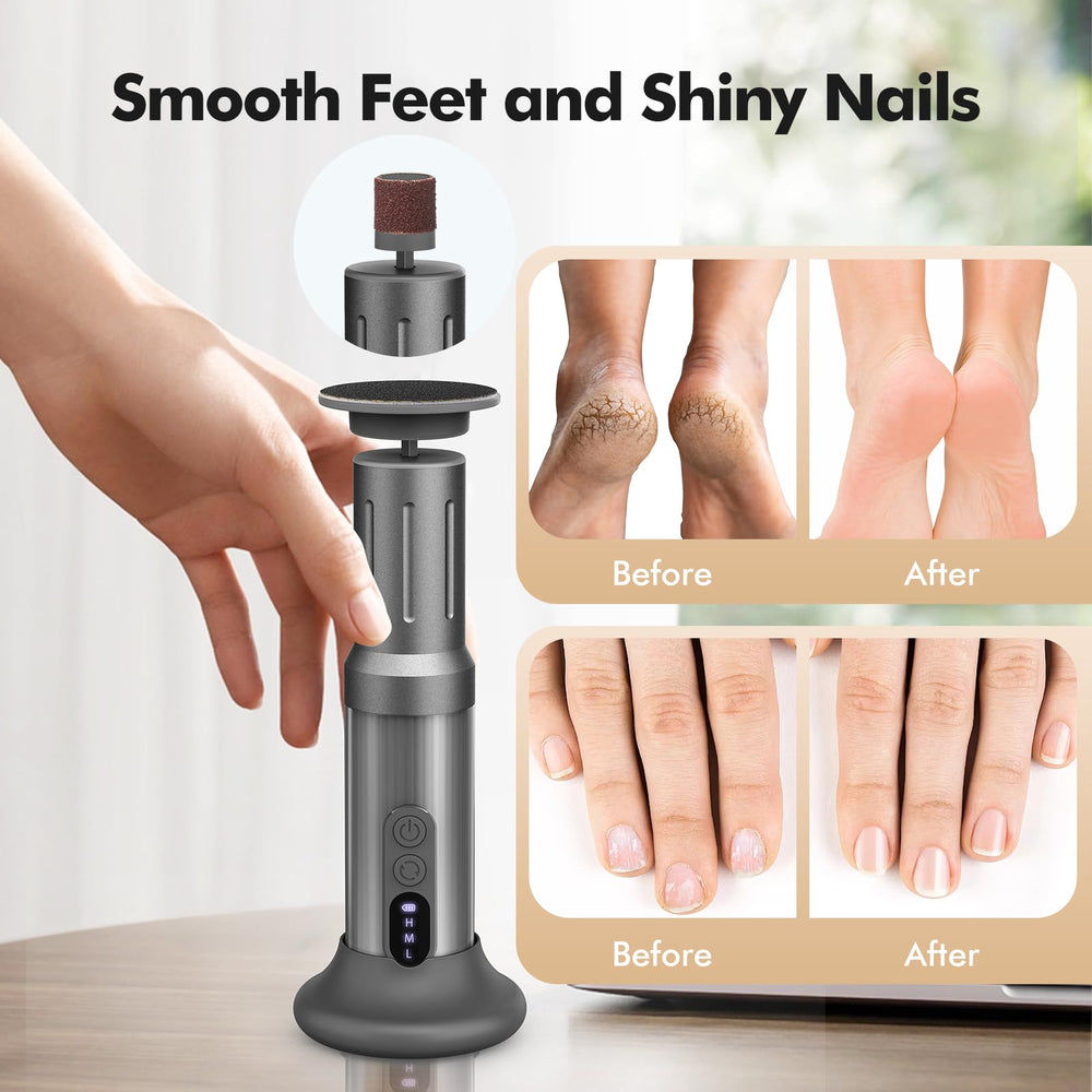 Xisuoka disques-sable-ongles, plaques abrasives pour une finition lisse des ongles.
